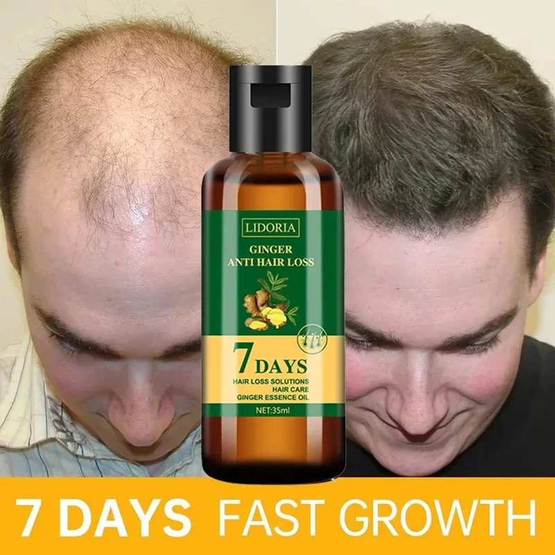 Hair Care Essential Oil Atomizing - Óleo Essencial de Crescimento do Cabelo