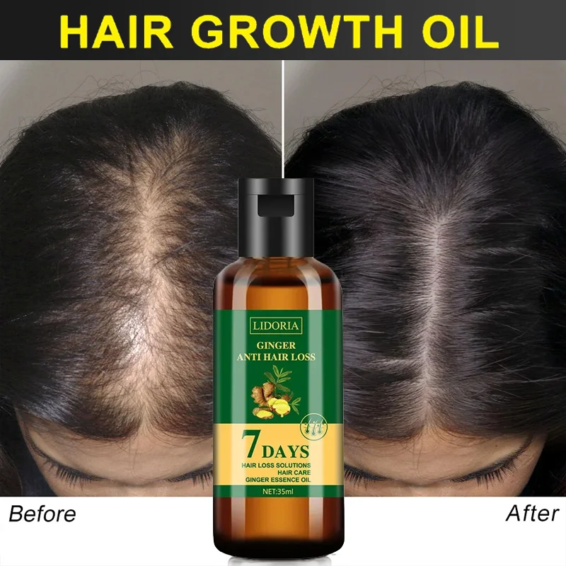 Óleo Essencial de Crescimento  - Hair Care Essential Oil Atomizing avaliação e preço