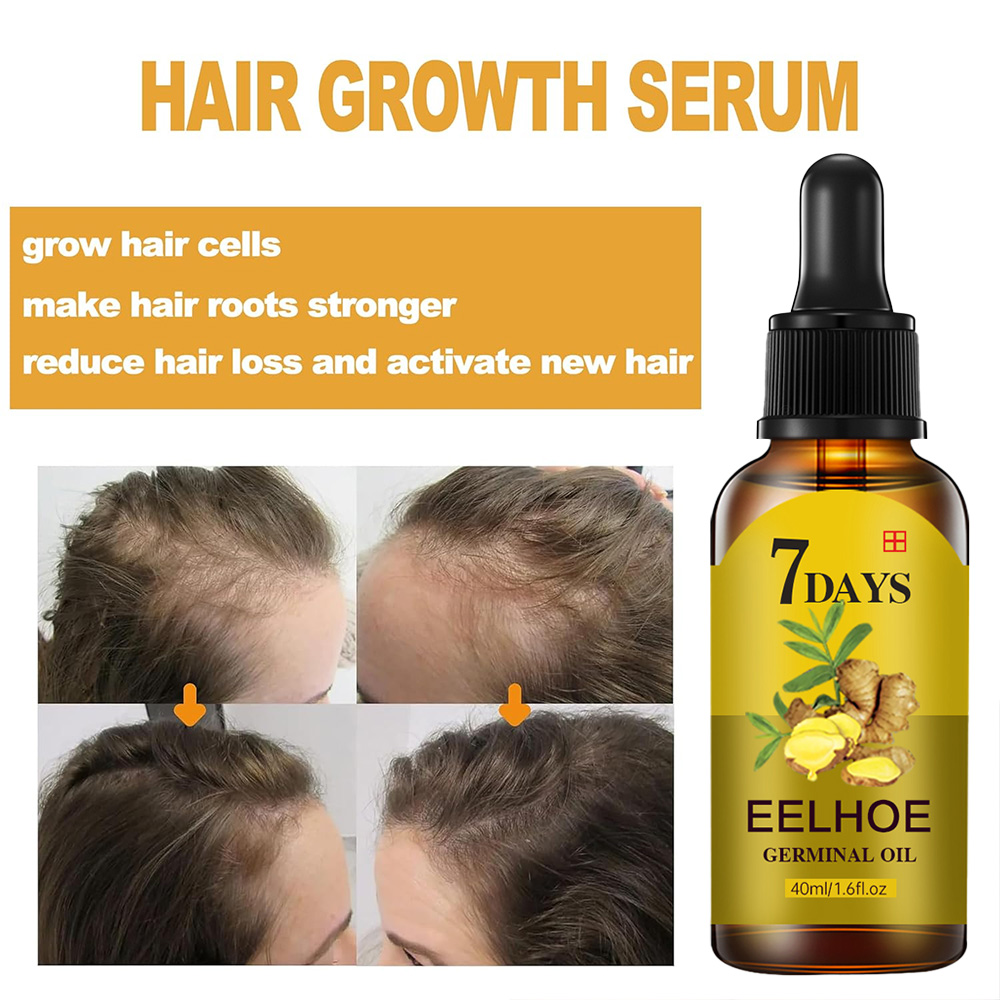 Soro de crescimento capilar, ó - Hair Care Essential Oil Atomizing avaliação e preço