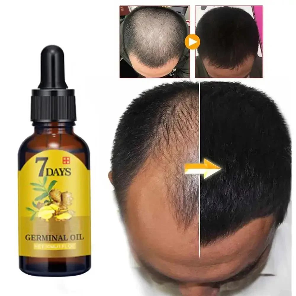 Crescimento do cabelo gengibre - Hair Care Essential Oil Atomizing avaliação e preço